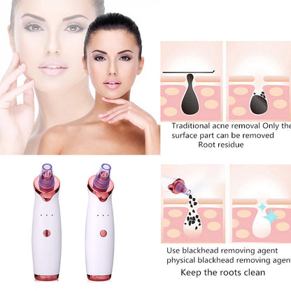 ELIONA Blackhead Remover